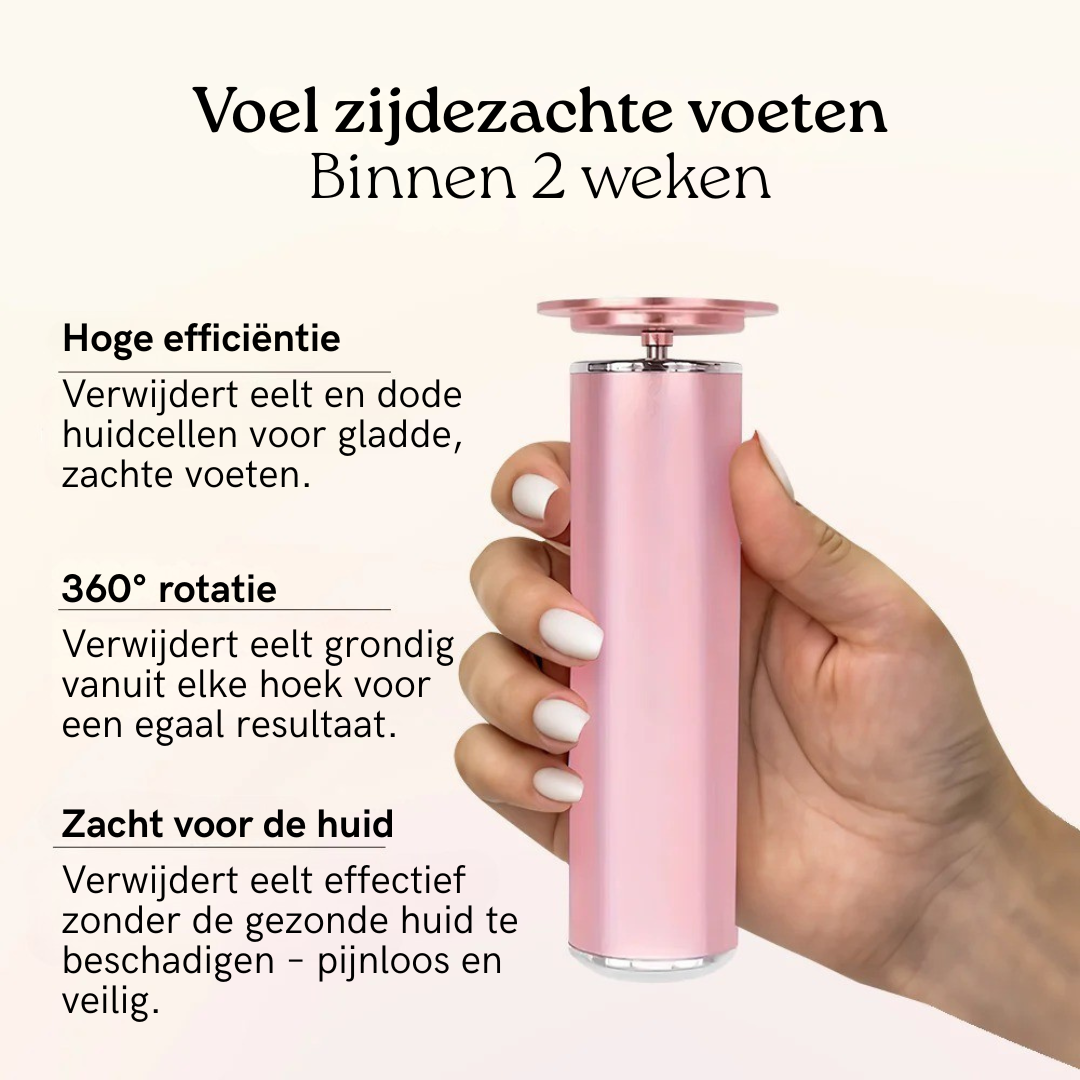 VelvetFeet - Elektrische Eeltverwijderaar